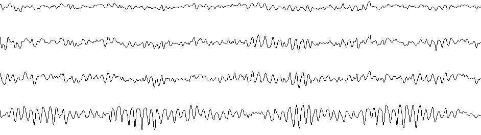 Brain EEG